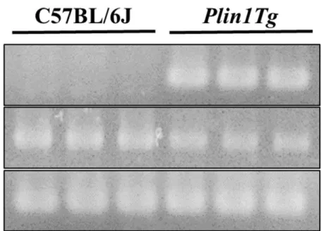 Figure 2  腹腔内マクロファージにおける PLIN1 導入遺伝子発現 