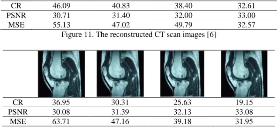 Figure 11. The reconstructed CT scan images [6] 