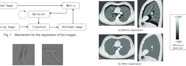 Fig. 2 Diﬀerence imageFig. 3 Diﬀerence image