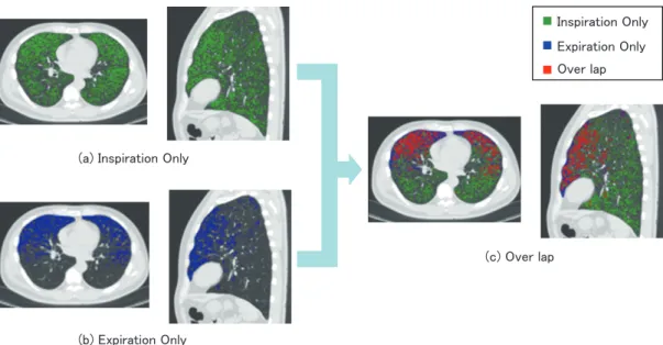 Fig. 4 LAA display
