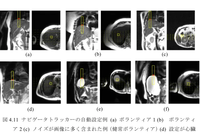 図 4.10  各方向での設定誤差