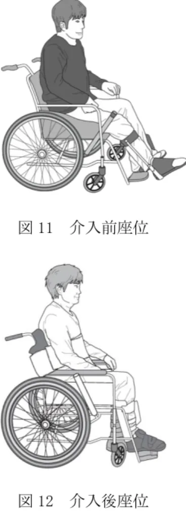 図 11  介入前座位  図 12  介入後座位  5ｍ走行速度は 16 秒から 15 秒とわずかながら に短縮された。さらに、右下肢の伸展痙性が抑 制されたため、フットプレートから落下するこ とがなくなり、棟内車椅子駆動が自立した。自 力での脱着は可能。  (4)  参加委員  多良麻由美（永生病院 OT）  芳澤松根（大西病院 PT）  亘理克治（嶋崎病院 PT）  杉山真理（埼玉県総合リハビリテーションセン ター PT）  ４）整備と管理  （１）シーティング  A)フレーム、シート、アームサポート、