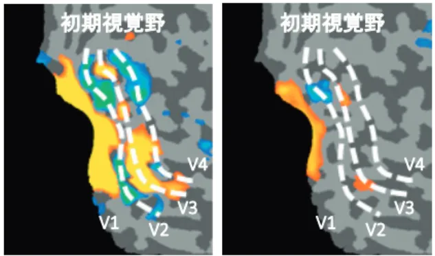 図 1　7 テスラ MRI における BOLD fMRI
