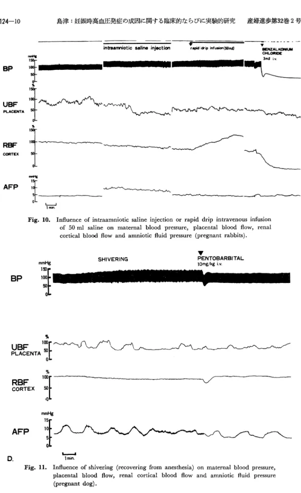 Fig.  10.  Influence  of  intraamniotic  saline  injection  or  rapid  drip  intravenous  infusion of  50ml  saline  on  maternal  blood  pressure,  placental  blood  flow,  renal cortical  blood  flow  and  amniotic  fluid  pressure  (pregnant  rabbits).