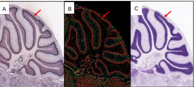 図 10. In situ hybridization によるマウス小脳における CKB mRNA の発現検出。 CKB mRNA がマウス小脳プルキンエ細胞において高発現していることが解る。A