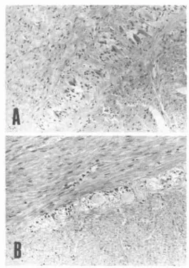 Fig.  2  A-plexus of the sigmoid colon. HE stainx 200. Nerve cells are reduced in number and show an enlargement of  cell bedies in  the constipated colon (B)  comparing to the control (A).