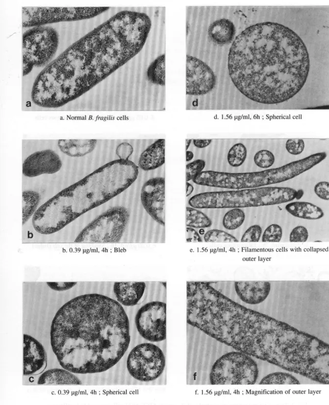 Fig. 3. Transmission electron micrographs of B. fragilis  ATCC 25285 cells exposed to levofloxacin.