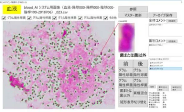 表 A6 菌候補領域 . つに対する菌種推定までの実行時 間比較 モデル 時間     かったこともまた相違が大きくなる原因であった  今後の課題として  本論文で使用した機械学習以外に も  ランダムフォレストや  近傍法などを用いて有効 性を検証することが挙げられる  また  機械学習の教師 データとなる菌のラベル付けの精度向上のため  実際の 医療関係者による教師データ作成ツールの作成  図 A も並行して進行している  図 A6 教師データ作成ツール 謝辞 本研究の重要な指針や貴重なコメントを頂いた