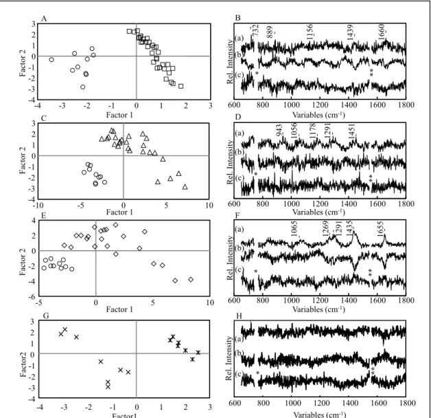 Fig.  2-6  Score  and  loading  plots  of  the  PLSR-DA  model  built  for  tumor  lesions  without  and  with  treatments with 5-FU (A, B), CDDP (C, D), and docetaxel (E, F)
