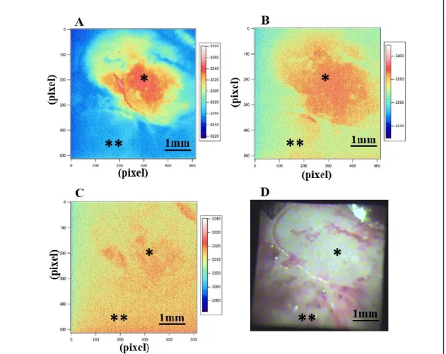 Fig. 3-2 AF- images of live tumor tissue and that of bright one. The topographies in A-C represent  concentration  of  NADH  (A),  FAD  (B)  and  collagen  (C)  respectively