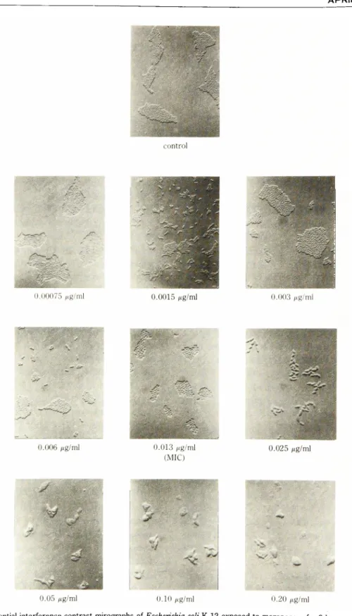 Fig.  4.  Differential  interference  contrast  mirographs  of  Escherichia  coli  K-12  exposed  to  meropenem  for  3  hours  at  37•Ž .