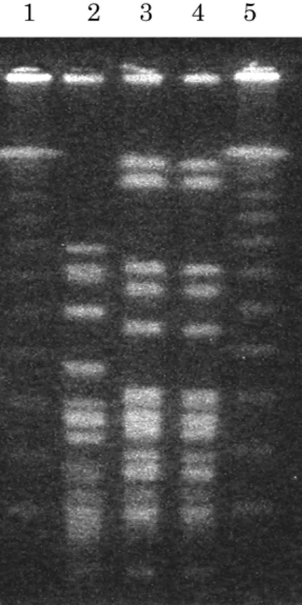 図  5 ．  S CV  株と  Revertant  株   Sma Ⅰ切断全ゲノム  DNA Pulsed-field       gel electrophoresis  レーン 1  およびレーン 5  ：分子量マーカー (28.5-970kbp) 、 レーン 2 ： E