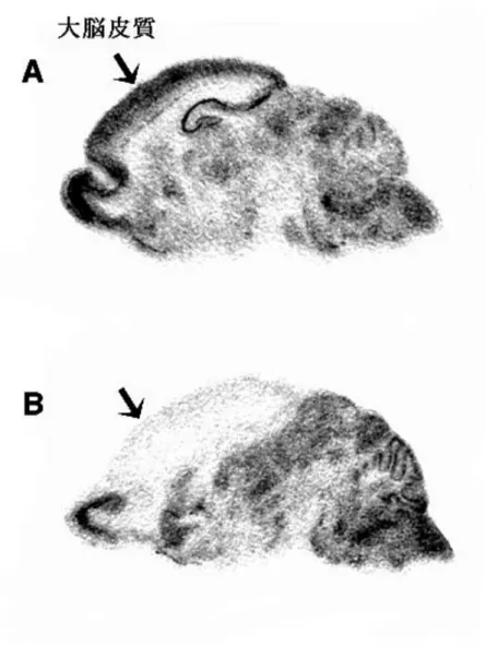 図 1-2  脳の断面と NMDAR1 遺伝子の発現パターン  A：野生型マウスにおける NMDAR1 遺伝子の発現パターン。ほとんどすべての神経 細胞で発現している。  B：大脳皮質特異的 NMDAR1 遺伝子ノックアウトマウスにおける NMDAR1 の発現 パターン。大脳皮質以外では野生型と同程度の発現があるが、大脳皮質では、 NMDAR1 遺伝子の発現は大きく減少している。詳細な解析により、このマウス の大脳皮質で NMDAR1 遺伝子を発現している細胞は、抑制性の神経細胞である ことが分かった。すな