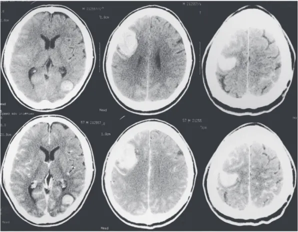 図 1 搬入時 CT（上段：単純 CT，下段：造影 CT）