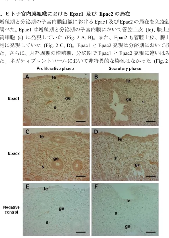 Figure 2. Epac1 and Epac2 are expressed in human endometrium 