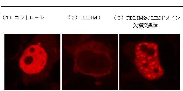 図 1 PDLIM2 による NF-κB の分解と核内輸送 (1) 培養細胞に NF-κB を発現させると、中央部の核の中の NF-κB が赤色の色素のつ いた抗体で染色される。 (2) ここに PDLIM2 を共に発現させると、核の中の赤色の染 色が消失し、 NF-κB が PDLIM2 により分解されたことがわかる。 (3) ユビキチン化に 必要な LIM ドメインを欠損させた PDLIM2 を NF-κB と共に発現させた場合には、 NF-κB は核内ボディに運ばれるが、ユビキチン化されていないために