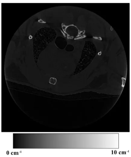 Figure 3.1: 画像のグレースケールと LAC 値の例