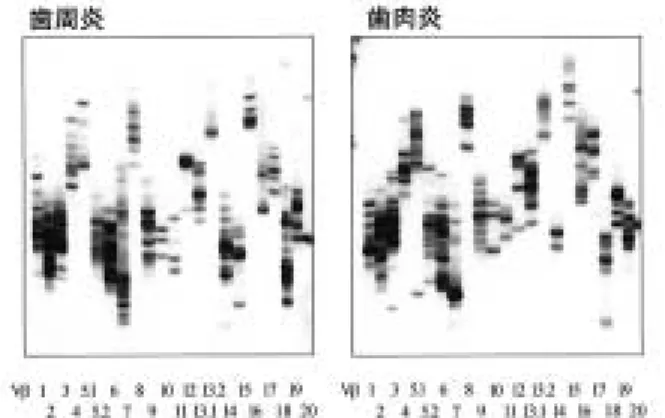 Fig. 4 末梢血，歯肉組織におけるIFN-γ，IL-10  mRNA発