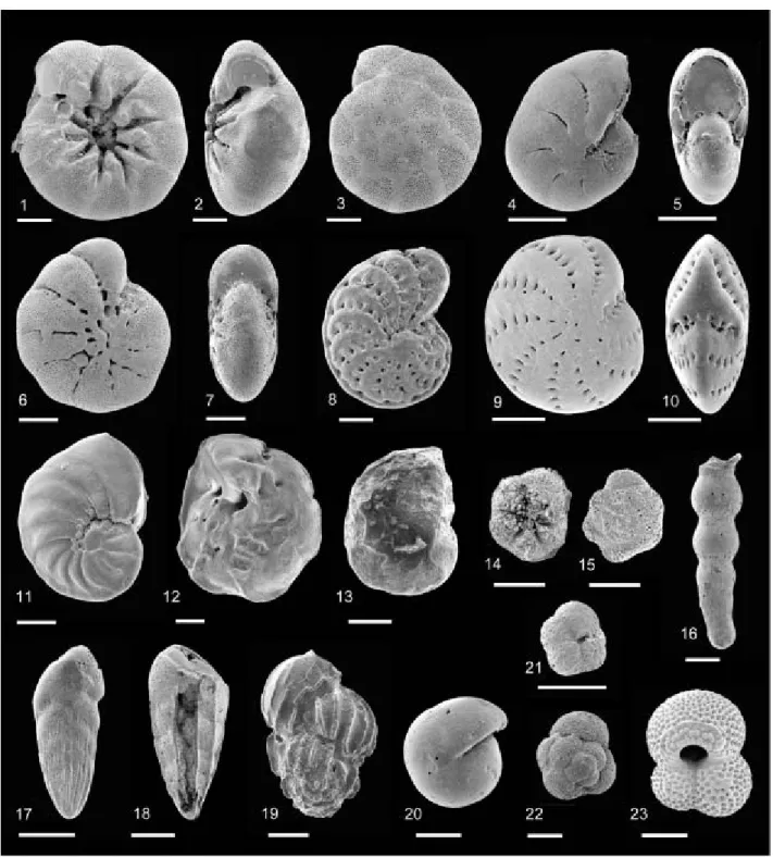 Fig.  9  SEM  microphotographs  of  the  major  foraminiferal  species  from  the  Furuya  Formation.  Scale  is  100 袙.(1)-(3) Ammonia beccarii (Linnaeus) from Sample 1-19; (4)-(5)  Elphidium subincertum Asano from Sample 9-02;  (6)-(7) Elphidium  excavat