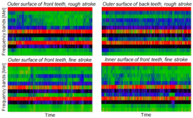 Fig. 2 MFCC representation of audio data from four toothbrushing activity classes.