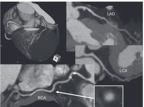 Fig. 5  Representative case 2. 