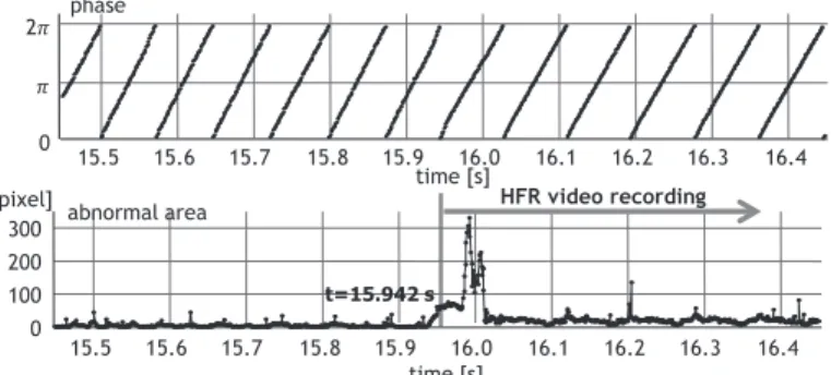 図 11 異常動作時に自動記録された HFR ビデオ．