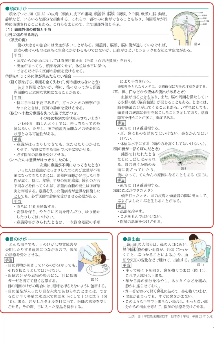 図 A 図 8 図 9 図 B図 10 図 11す い ほ うと う が い こ つの う ま くな い け っ し ゅと う が いけ い れ んび こ うま   ひど う こ うの う せ き ず い え きび ち ゅ う か く ね ん ま く●頭のけが 頭を打つと、頭（図 A）の皮膚（頭皮）、皮下の組織、頭蓋骨、脳膜（硬膜、クモ膜、軟膜）、脳、動脈、静脈など、いろいろな部分を損傷する。これらの一部のみに傷ができることもあり、何箇所かが同時に破壊されることもある。これらをまとめて、全て頭部外傷と呼ぶ。