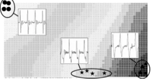 図 27 変曲点 c，d 点が判別できない脈波の例 Fig. 27 An example of waveform with unclear inflection