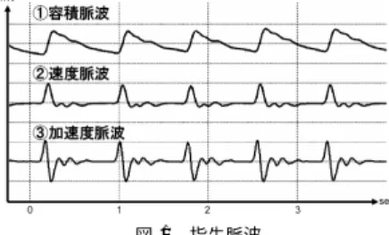 図 2 加速度脈波の変曲点