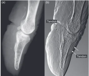 Fig. 4   Images of human cadavers taken with the apparatus shown in  Fig. 2: (a) an attenuation contrast image of a right thumb aligned  in the upright position, and (b) a corresponding differential phase  contrast image