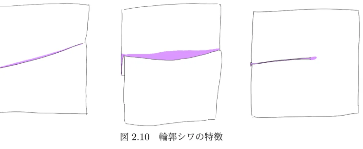 図 2.10 輪郭シワの特徴
