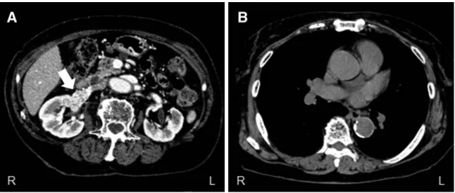Fig. 1 Abdominal and chest CT findings.