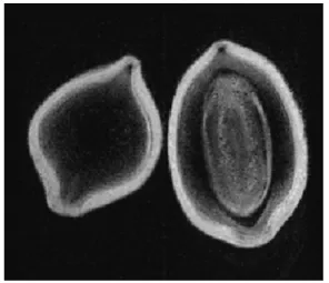 図 11 そら豆の MR 画像（水の濃度分布。高濃度を白色，低 濃度を黒色で示した）この視点で式(9) を見直すと，tphaseが一定値であるから，Dqiを増加させるにはGy,iを増加させる必要がある。そのため，位相エンコードではGy,iをdGyずつ増加させる操作をする。dGyずつGy,iを増加させる操作をNphase回繰り返すことで，Dqiをiが1からNphase番目までの信号として取得することができる。この操作はNread個の信号を取得した式(10) の周波数エンコードと同じであることが分かる。したがっ