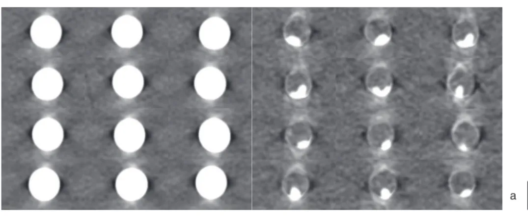 Fig. 12  CT urography に対する virtual non-contrast の応用