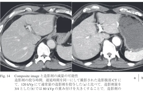 Fig. 14  Composite image と造影剤の減量の可能性