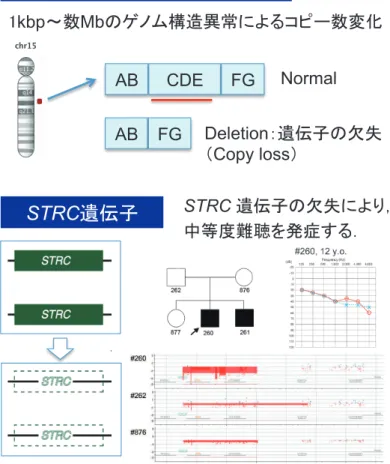 Fig e 1.  Audi gram  o   e  ob d a d si ling  with homo ygo   RC deletions  A ogr ms  how mild to moder te  e g l ss 