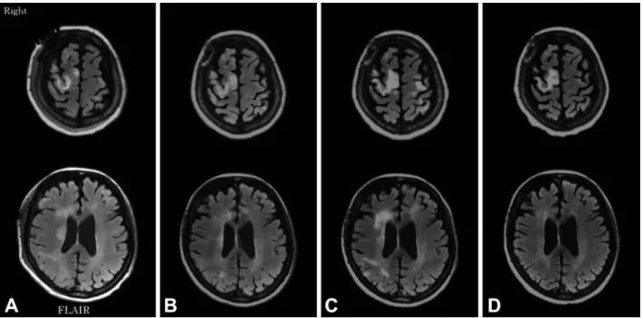 Fig. 4 Chronological changes shown by brain MRI.