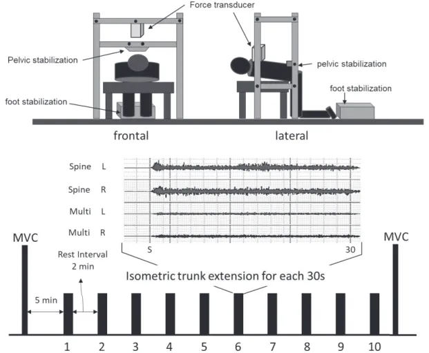 Figure 1 An overview of the position in trunk extension, and protocol and raw surface electromyography(EMG) for 30s during intermittent contractions