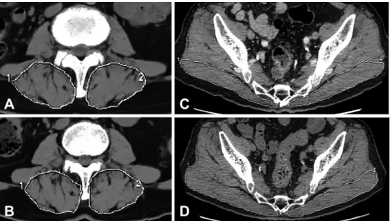 Fig. 3 Pathological examination of biopsy specimens from the left quadriceps muscle.