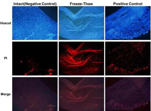 Figure 11.  半月板組織の Cell viability test の結果。  凍結解凍した半月板組織と Positive control の PI に染 まった細胞核の数は Hoechst 染色液に染まった細胞核の数と 99％以上一致した。