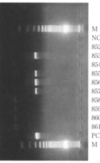 Fig.  4  The  detection  of  NIX  among  patients  in  ward  B. 2/5に 患 者 と の 接 触 は 無 い.集 団 発 生 の 原 因 が,医 師 の 発 症 と 関 連 が あ る か ど う か は,医 師 の 便 の 検 査 を そ の 時 点 で 行 う こ と が で き な か っ た た め(症 状 改 善 後4名 に 施 行,す べ て 陰 性)不 明 で あ る
