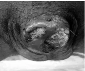 Fig. 2. Gross appearance showed swollen penis and the glans was irregular.