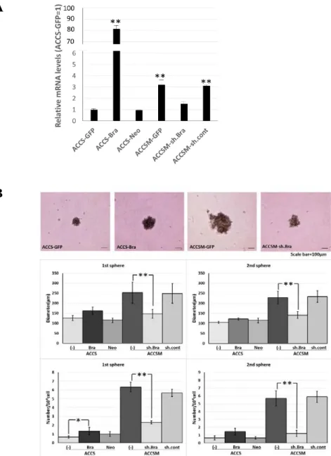 Figure 1. Effects of BRACHYURY transfection on the sphere-forming ability of ACCS  (adenoid cystic carcinoma) cells