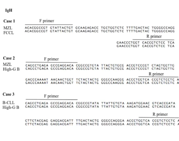 Fig.  3-2.  Nucleotide  sequence  comparison  of  complementary  determining  region  (CDR)  3  between  two  corresponding  lesions  in  three  cases