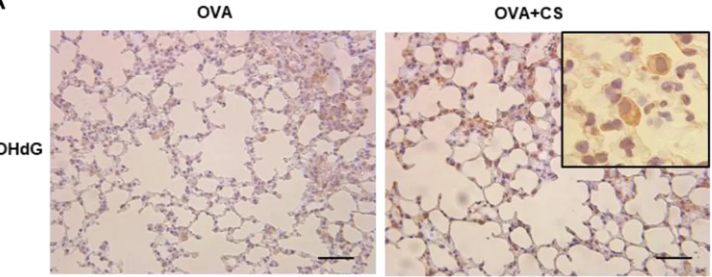 Figure 5.  アレルギー性気道炎症モデルマウスにおけるタバコ煙曝露による酸化ストレスと