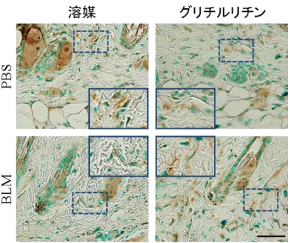 図 9  皮膚における MMP-13 発現の検討:皮膚における MMP-13 染色を行った。