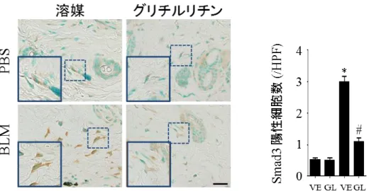 図 12  線維芽細胞における Smad3 の核内、核外発現の検討：皮膚における Smad3 染色を行った。また核内が Smad3 陽性となった細胞数の計測を行った。スケー ルバーの大きさは 20m を示す。  それぞれのグラフは平均値  ±  標準誤差を示 す。 (n = 6–7)、 VE:溶媒、 GL:グリチルリチン、 *P<0.05 versus PBS-VE 群、 # P<0.05 