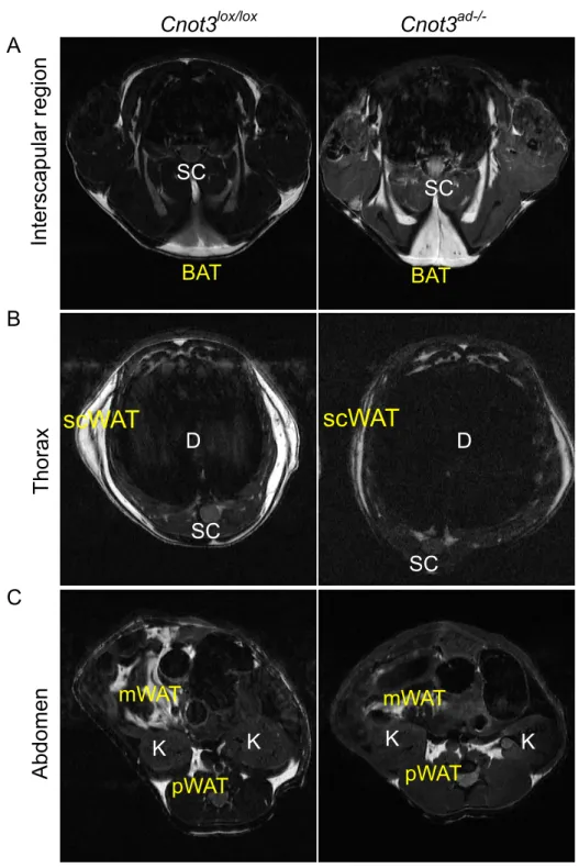 Figure 7. MRI imaging of wild-type (left) and Cnot3 ad-/- (right) mice at 8 weeks on ND  feeding