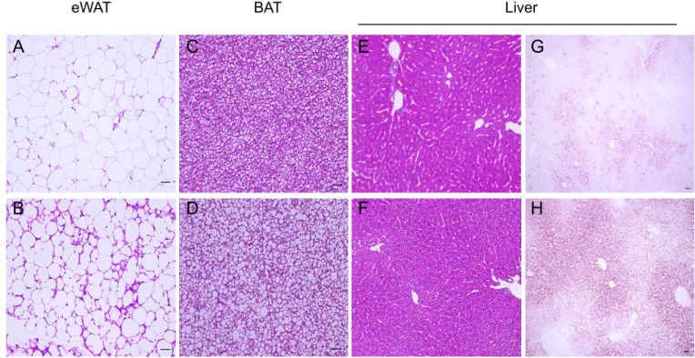 Figure 8. An abnormal lipid accumulation in the liver and BAT of Cnot3 ad-/-  mice. 
