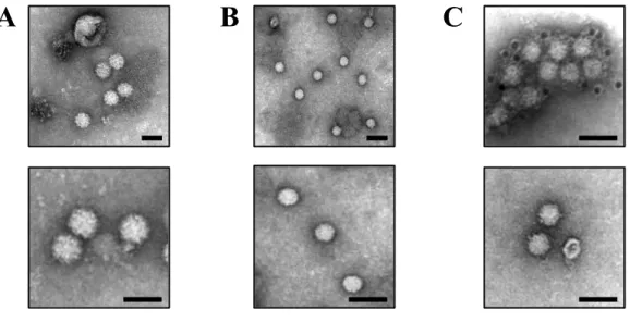 Fig. 6.  Observation of two distinct forms of rat HEV particles by TEM. (A) TEM images  of  negatively  stained  membrane-associated  rat  HEV  particles  in  the  exosome  fraction  of  culture supernatant and (B) membrane-unassociated rat HEV particles i
